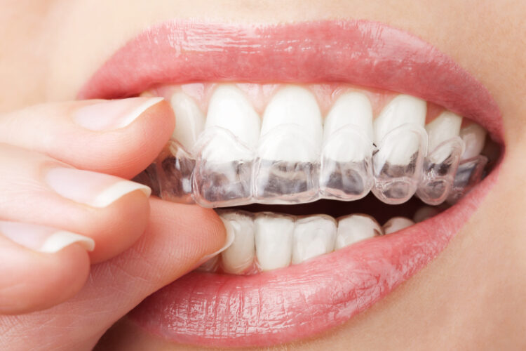 straighten teeth, invisalign, orthodontics